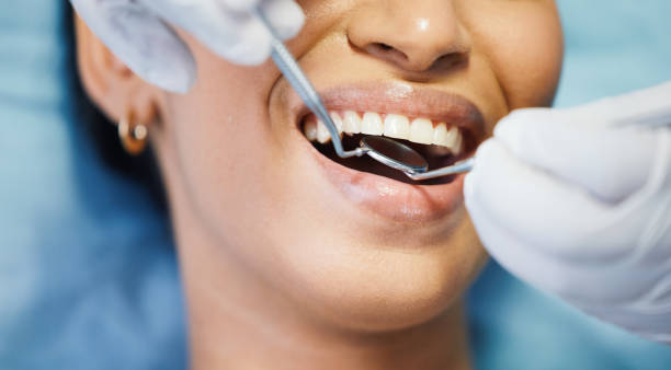 Best Holiday Emergency Dentist in Newberg, OR